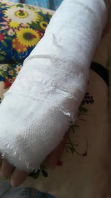安陽沃爾瑪顧客摔成骨折商場推委扯皮